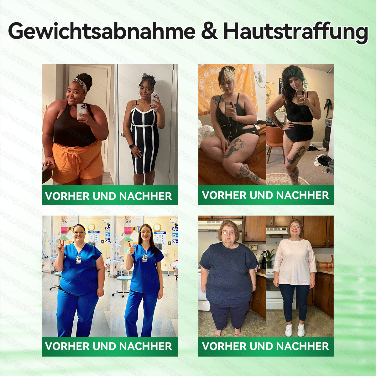 🇦🇹𝐎𝐟𝐟𝐢𝐳𝐢𝐞𝐥𝐥𝐞𝐫 𝐒𝐡𝐨𝐩 |❤❤𝑮𝑳𝑶𝐑𝐄𝐍𝐃𝘼®𝙈𝙤𝙧𝙞𝙣𝗴𝗮 · 𝗕𝗲𝗿𝗯𝗲𝗿𝒊𝒏 × 𝑵𝘼𝘿+ 10-𝙞𝙣-𝟏 𝐀𝐝𝐯𝐚𝗻𝗰𝗲𝗱 𝗡𝗮𝙣𝙤 𝙈𝙞𝙠𝙧𝐨𝐧𝐚𝐝𝐞𝐥-𝐏𝐚𝒕𝒄𝗵(𝐍𝐮𝐫 𝐞𝐢𝐧𝐦𝐚𝐥 𝐭ä𝐠𝐥𝐢𝐜𝐡, 𝐬𝐢𝐜𝐡𝐭𝐛𝐚𝐫𝐞 𝐕𝐞𝐫ä𝐧𝐝𝐞𝐫𝐮𝐧𝐠𝐞𝐧 𝐢𝐧 𝟕 𝐓𝐚𝐠𝐞𝐧)✅ 𝐅ü𝐫 𝐅𝐞𝐭𝐭𝐥𝐞𝐢𝐛𝐢𝐠𝐤𝐞𝐢𝐭, 𝐇𝐚𝐮𝐭𝐬𝐭𝐫𝐚𝐟𝐟𝐮𝐧𝐠, 𝐃𝐢𝐚𝐛𝐞𝐭𝐞𝐬, 𝐒𝐜𝐡𝐥𝐚𝐟𝐚𝐩𝐧𝐨𝐞, 𝐆𝐞𝐥𝐞𝐧𝐤𝐩𝐫𝐨𝐛𝐥𝐞𝐦𝐞 𝐮𝐧𝐝 𝐦𝐞𝐡𝐫!