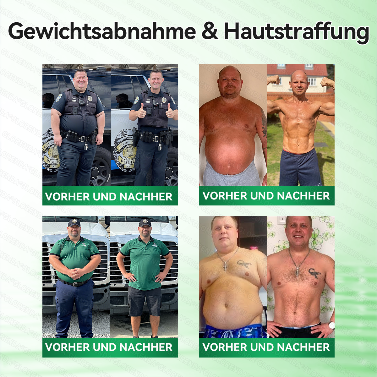 🇦🇹𝐎𝐟𝐟𝐢𝐳𝐢𝐞𝐥𝐥𝐞𝐫 𝐒𝐡𝐨𝐩 |❤❤𝑮𝑳𝑶𝐑𝐄𝐍𝐃𝘼®𝙈𝙤𝙧𝙞𝙣𝗴𝗮 · 𝗕𝗲𝗿𝗯𝗲𝗿𝒊𝒏 × 𝑵𝘼𝘿+ 10-𝙞𝙣-𝟏 𝐀𝐝𝐯𝐚𝗻𝗰𝗲𝗱 𝗡𝗮𝙣𝙤 𝙈𝙞𝙠𝙧𝐨𝐧𝐚𝐝𝐞𝐥-𝐏𝐚𝒕𝒄𝗵(𝐍𝐮𝐫 𝐞𝐢𝐧𝐦𝐚𝐥 𝐭ä𝐠𝐥𝐢𝐜𝐡, 𝐬𝐢𝐜𝐡𝐭𝐛𝐚𝐫𝐞 𝐕𝐞𝐫ä𝐧𝐝𝐞𝐫𝐮𝐧𝐠𝐞𝐧 𝐢𝐧 𝟕 𝐓𝐚𝐠𝐞𝐧)✅ 𝐅ü𝐫 𝐅𝐞𝐭𝐭𝐥𝐞𝐢𝐛𝐢𝐠𝐤𝐞𝐢𝐭, 𝐇𝐚𝐮𝐭𝐬𝐭𝐫𝐚𝐟𝐟𝐮𝐧𝐠, 𝐃𝐢𝐚𝐛𝐞𝐭𝐞𝐬, 𝐒𝐜𝐡𝐥𝐚𝐟𝐚𝐩𝐧𝐨𝐞, 𝐆𝐞𝐥𝐞𝐧𝐤𝐩𝐫𝐨𝐛𝐥𝐞𝐦𝐞 𝐮𝐧𝐝 𝐦𝐞𝐡𝐫!